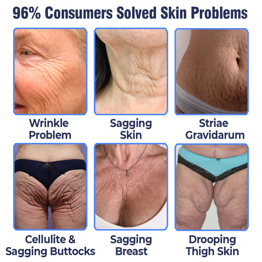 flysmus®Advanced Tightening & Wrinkles Reducing Lotion🌿