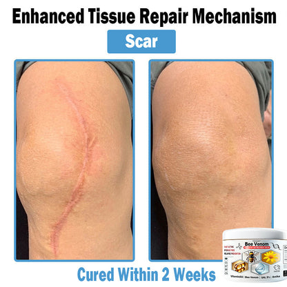 TODAHOF™ Bee Venom Multi-Symptom Skin Treatment Cream (👨‍⚕NPF RECOMMENDS)