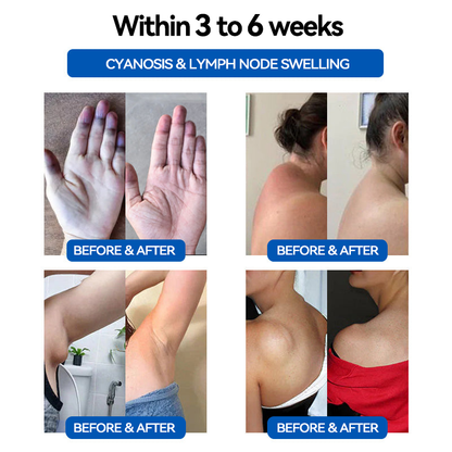JoM𝖾𝖽𝗂𝗑™ 👩‍⚕️𝐔𝐥𝐭𝐫𝐚𝐬𝐨𝐧𝐢𝐜 𝐅𝐚𝐭 𝐁𝐥𝐚𝐬𝐭𝐢𝐧𝐠 𝐚𝐧𝐝 𝐃𝐞𝐭𝐨𝐱𝐢𝐧𝐠 𝐖𝐫𝐢𝐬𝐭𝐛𝐚𝐧𝐝