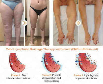 JoM𝖾𝖽𝗂𝗑™ 👩‍⚕️𝐔𝐥𝐭𝐫𝐚𝐬𝐨𝐧𝐢𝐜 𝐅𝐚𝐭 𝐁𝐥𝐚𝐬𝐭𝐢𝐧𝐠 𝐚𝐧𝐝 𝐃𝐞𝐭𝐨𝐱𝐢𝐧𝐠 𝐖𝐫𝐢𝐬𝐭𝐛𝐚𝐧𝐝