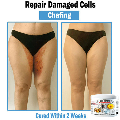 TODAHOF™ Bee Venom Multi-Symptom Skin Treatment Cream (👨‍⚕NPF RECOMMENDS)